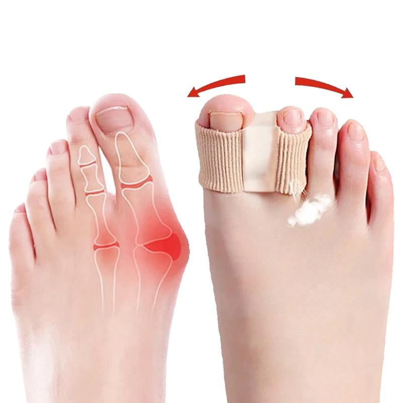 Bunion Corrector